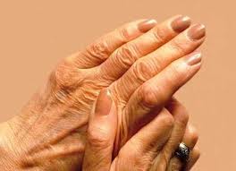 Acute Arthritis Homeopathic Medicine